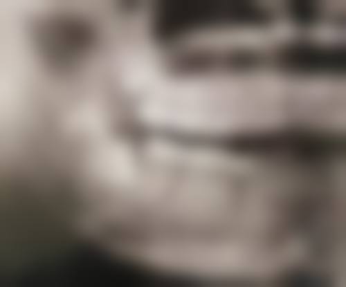 张玉涛擅长项目列表