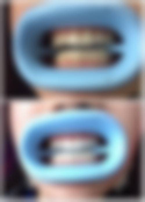 王玉钏预约方式