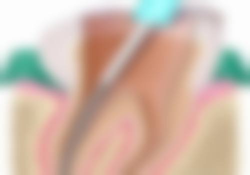 浙江金华东阳博众口腔医院价格表（仅供参考）