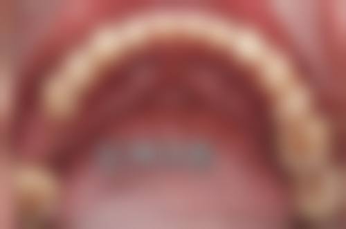 济南历下博凡特口腔怎么预约？