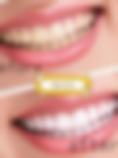 重庆渝北一安口腔价格表（仅供参考）