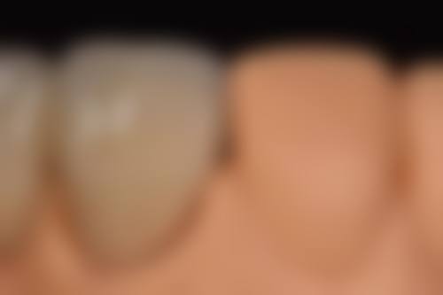 欧雅口腔门诊部价格表（仅供参考）