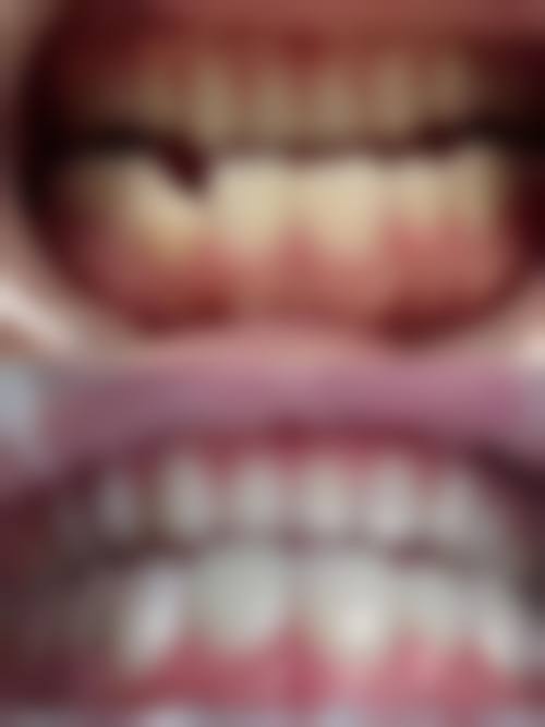 中山石岐口腔医院核心项目