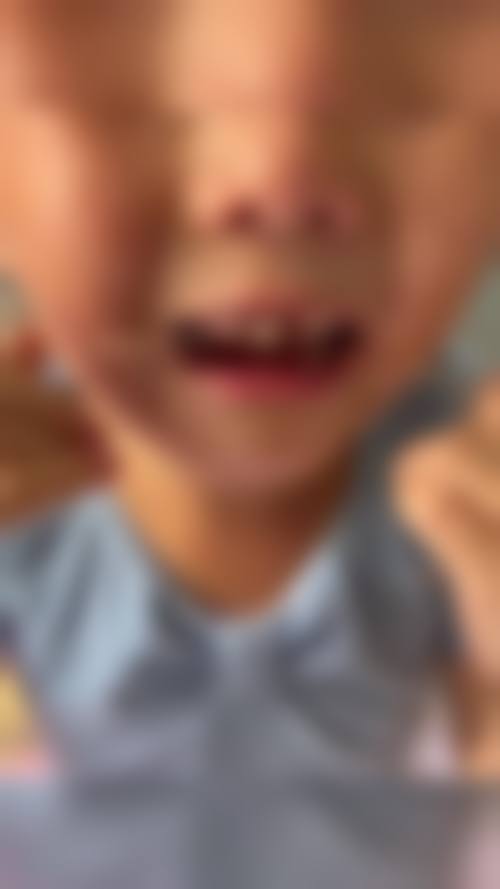 高平晨曦口腔诊所价格表(仅供参考)