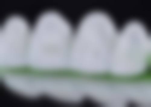 商丘华医口腔门诊价格表(仅供参考)