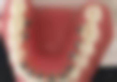 赵雪忠患者评价