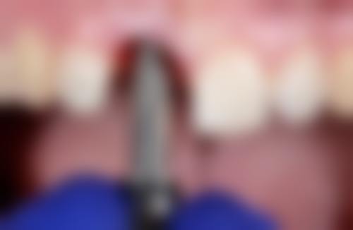 大理众牙口腔门诊部怎么预约?