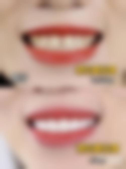 湖北荆州孔医生口腔实例参考