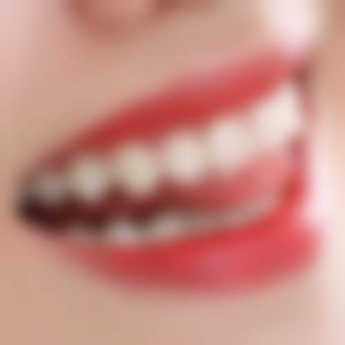 山东临沂沂南爱中口腔门诊部核心项目