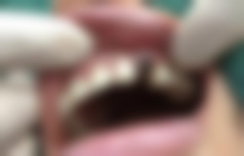 钱谕莹患者评价