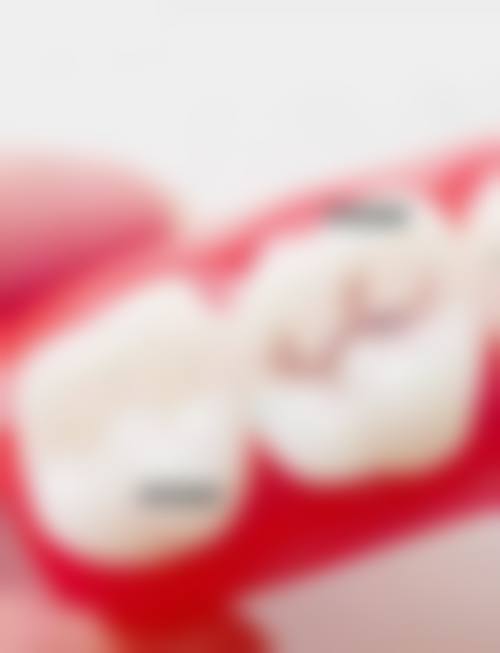 兴安盟人民医院口腔科核心项目