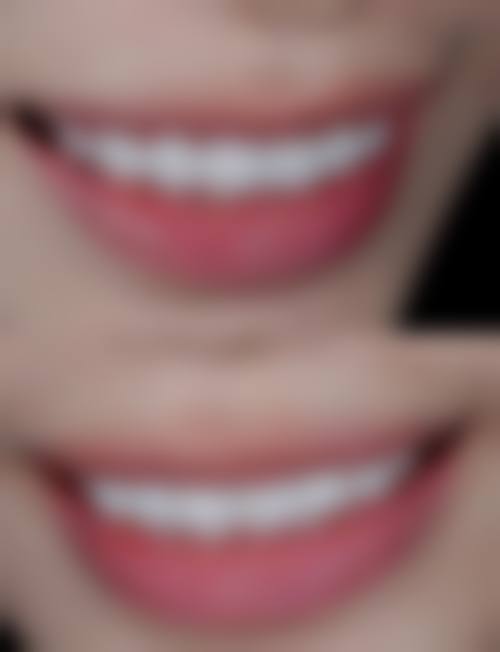 廉文静擅长项目列表