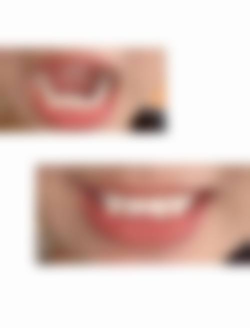 成都诺美嘉口腔诊所核心项目