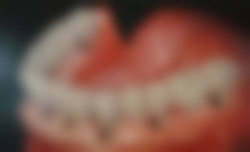 高琳擅长项目列表