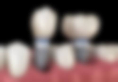 高琳资质与专精介绍