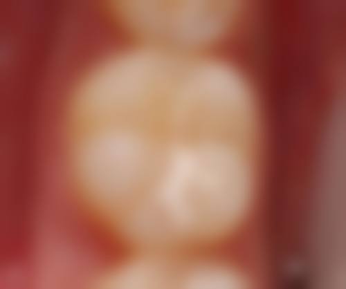 乐山皓贝口腔门诊部怎么预约？