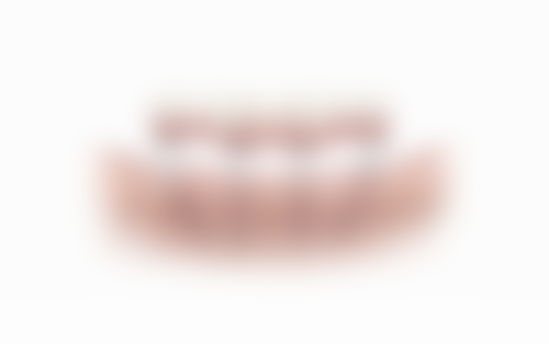 伍芳芳患者评价