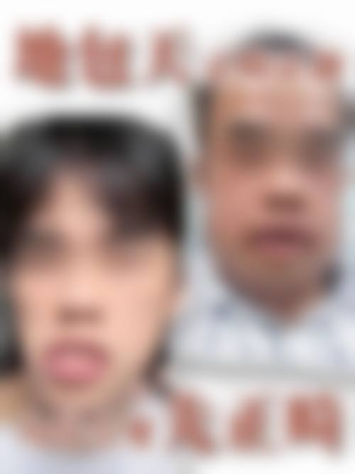 伍芳芳擅长项目列表