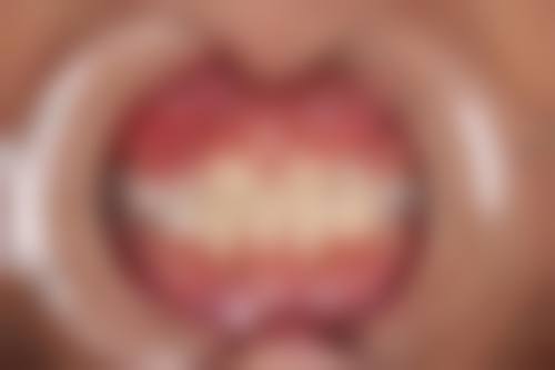 伍芳芳擅长项目列表