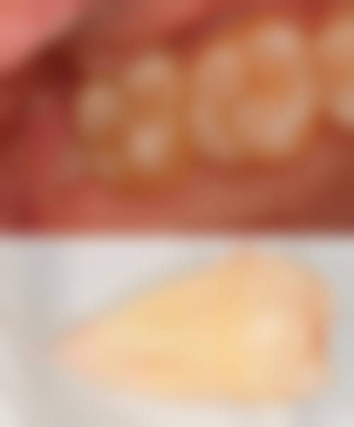 潮州万民牙病防治所整形科核心项目