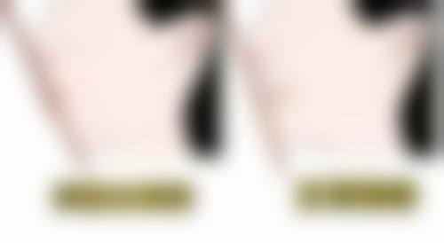 韩国必瘦B医院价格表（仅供参考）