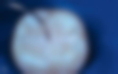 茂名电白佳乐口腔门诊部擅长项目有哪些?