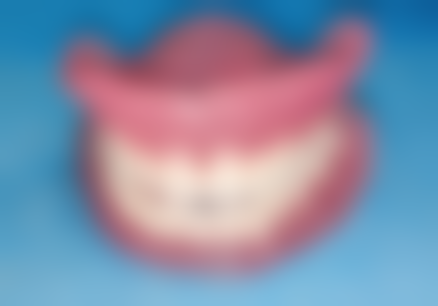 荆门美博口腔价格表(仅供参考)