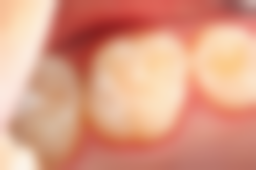 常熟雅博口腔医生团队解析