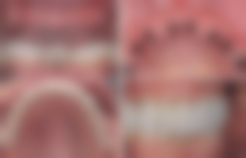 眉山贝森口腔门诊医生团队解析