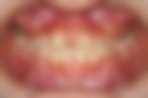 眉山贝森口腔门诊2026价格表参考