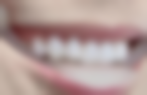 西安瑞泰口腔医院地址及到院路线