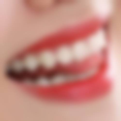 山东淄博张店亿诺利诺口腔医生团队解析