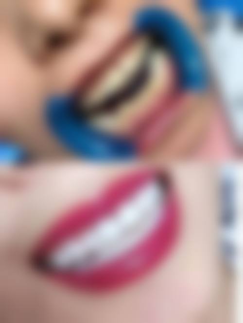 山东淄博张店亿诺利诺口腔2026价格表参考