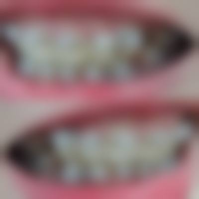 山东淄博张店亿诺利诺口腔技术设备怎么样？