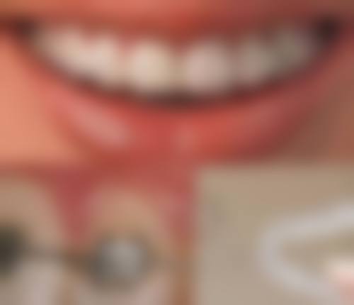 山东淄博张店亿诺利诺口腔口碑评价