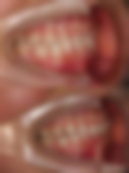 昆明医 科 大学附属口腔医院儿童口腔科2026价格表参考