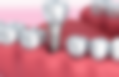 周燕军擅长项目列表