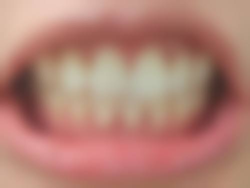 株洲爱齿口腔口碑评价