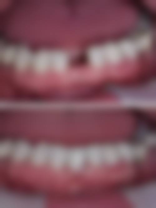 河北邢台南和小徐口腔2026价格表参考