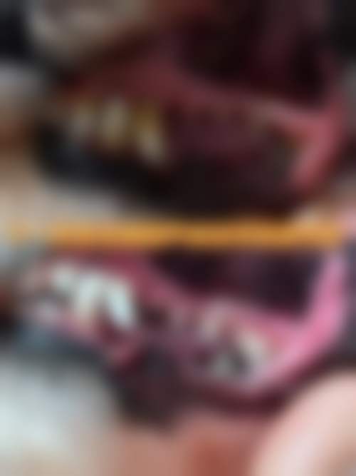 深圳华度口腔门诊部医生团队解析