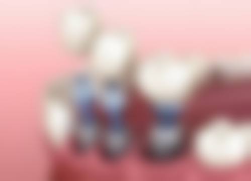 江苏徐州合美口腔医生团队解析