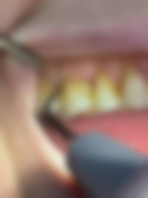 伊宁德灵口腔诊所口碑评价