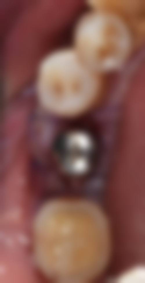 刘伟江擅长项目列表