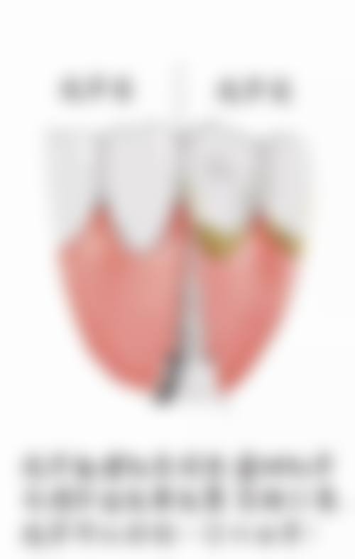 天津静海美雅口腔门诊部医生团队解析