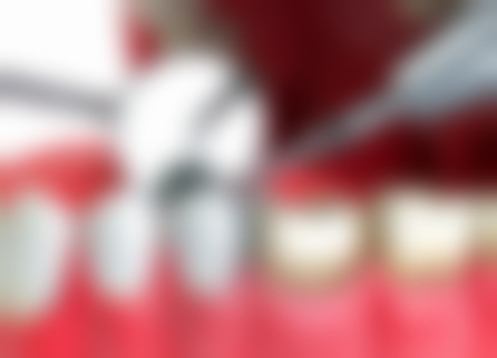 山东济南槐荫聚康口腔口碑评价