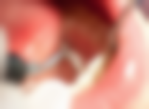 临沂兰山王泳伟口腔诊所口碑评价