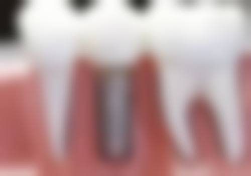 甘肃白银鸿冠口腔技术设备怎么样？