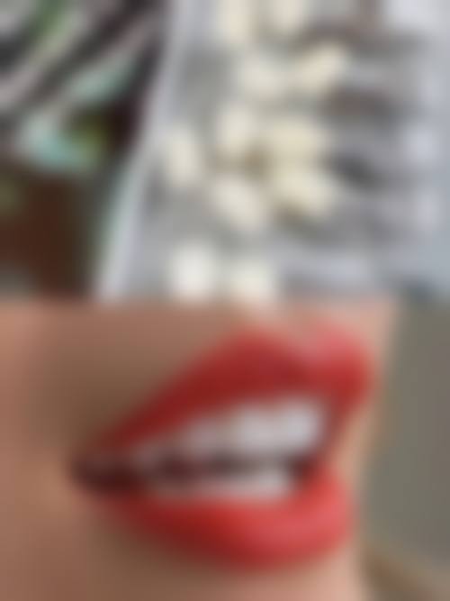 安徽合肥爱牙乐口腔擅长项目有哪些?