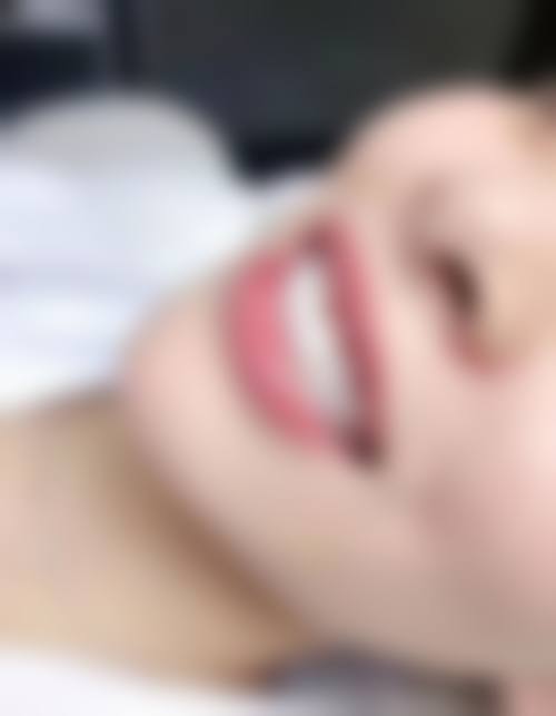 湖北宜昌福鑫口腔医生团队解析