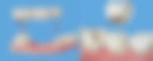 浙江省人民医院口腔科医生团队解析